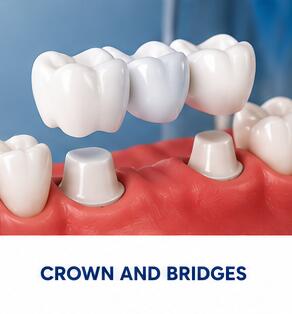 Crown