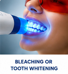 Whitening